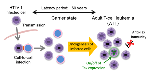 adult T-cell leukemia